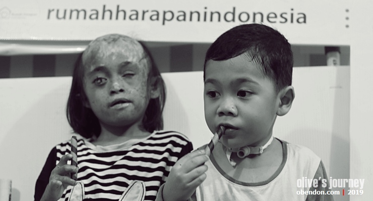 rumah harapan indonesia, adik dampingan di rhi, galang dana untuk rhi, sakit jantung bawaan pada anak